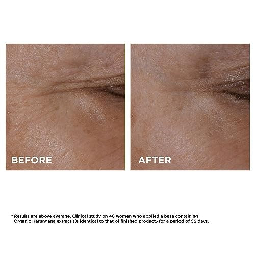 Clarins Total Eye Lift Eye Cream – 0.5 oz / 15 ml